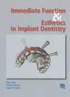 Immediate Function & Esthetics in Implant Dentistry 1850971730 Book Cover