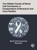 The Hidden Facets of Renal Cell Carcinoma: A Compendium of Research and Case Studies 1022897489 Book Cover
