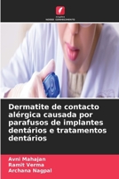 Dermatite de contacto alérgica causada por parafusos de implantes dentários e tratamentos dentários (Portuguese Edition) 6630201132 Book Cover