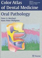 Color Atlas of Dental Medicine: Oral Pathology 0865779325 Book Cover