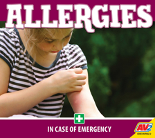 Allergies 1791126561 Book Cover