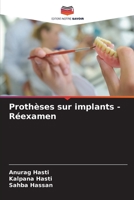 Prothèses sur implants - Réexamen 6205893568 Book Cover