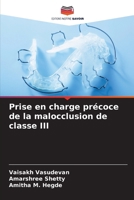 Prise en charge précoce de la malocclusion de classe III (French Edition) 6206957608 Book Cover