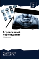 Агрессивный периодонтит: Обновление 6204052004 Book Cover
