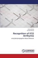 Recognition of ECG Arrthymia 3659240281 Book Cover