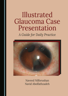 Illustrated Glaucoma Case Presentation: A Guide for Daily Practice 1036405176 Book Cover