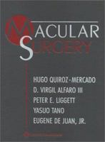 Macular Surgery 0781797152 Book Cover
