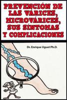 Prevencion de Las Varices, Microvarices, Sus Sintomas y Complicaciones: 1546398678 Book Cover