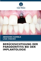 BERÜCKSICHTIGUNG DER PARODONTITIS BEI DER IMPLANTOLOGIE 6205888181 Book Cover