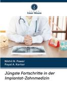 Jüngste Fortschritte in der Implantat-Zahnmedizin 6202838469 Book Cover