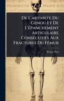 De L'arthrite Du Genou Et De L'Ã(c)panchement Articulaire ConsÃ(c)cutifs Aux Fractures Du FÃ(c)mur (French Edition) 1024467430 Book Cover
