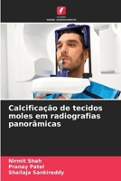 Calcificação de tecidos moles em radiografias panorâmicas (Portuguese Edition) 6208274362 Book Cover