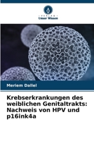 Krebserkrankungen des weiblichen Genitaltrakts: Nachweis von HPV und p16ink4a 6205981904 Book Cover
