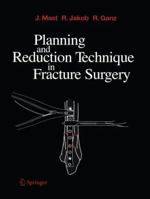 Planning and Reduction Technique in Fracture Surgery 3642647847 Book Cover