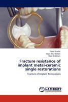 Fracture resistance of implant metal-ceramic single restorations: Fracture of Implant Restorations 3844387803 Book Cover