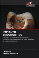 Impianto Endodontico (Italian Edition) 6209965458 Book Cover