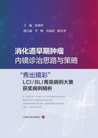Endoscopic Diagnosis and Treatment Strategies for Early Gastrointestinal Tumors: Selected Analysis of Award-Winning Cases from the "Showcasing ... Case ... ???????????--"?& (Chinese Edition) 7547870384 Book Cover