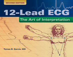 12-Lead Ecg: The Art of Interpretation: The Art of Interpretation 0763773514 Book Cover