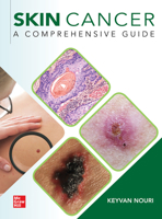Skin Cancer 1260453006 Book Cover