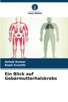 Ein Blick auf Gebärmutterhalskrebs (German Edition) 6207863143 Book Cover