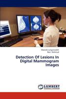 Detection of Lesions in Digital Mammogram Images 365930932X Book Cover
