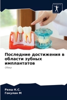 Последние достижения в области зубных имплантатов: Обзор 6204059874 Book Cover