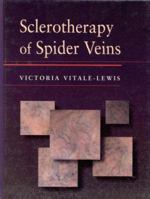 Sclerotherapy of Spider Veins 0750694599 Book Cover