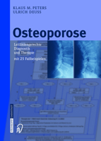 Osteoporose: Leitliniengerechte Diagnostik und Therapie mit 25 Fallbeispielen 3798514658 Book Cover