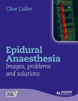 Epidural Anaesthesia: Images, Problems and Solutions 1444156047 Book Cover