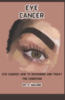 EYE CANCER: EYE CANCER: HOW TO RECOGNIZE AND TREAT THE CONDITION B0CGKKQ9GQ Book Cover