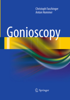 Gonioscopy 3662521164 Book Cover