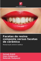 Facetas de resina composta versus facetas de cerâmica (Portuguese Edition) 6208587980 Book Cover