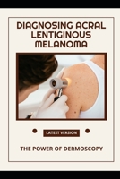 Diagnosing Acral Lentiginous Melanoma: The Power of Dermoscopy B0FP4HV75Z Book Cover