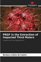 PRGF in the Extraction of Impacted Third Molars 6209462502 Book Cover
