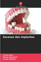 Sucesso dos implantes (Portuguese Edition) 6202666390 Book Cover