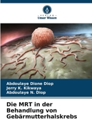Die MRT in der Behandlung von Gebärmutterhalskrebs (German Edition) 6209567231 Book Cover