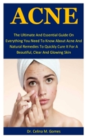 Acne: The Ultimate And Essential Guide On Everything You Need To Know About Acne And Natural Remedies To Quickly Cure It For A Beautiful, Clear And Glowing Skin 1710301287 Book Cover