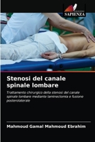 Stenosi del canale spinale lombare: Trattamento chirurgico della stenosi del canale spinale lombare mediante laminectomia e fusione posterolaterale 620354499X Book Cover