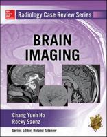 Radiology Case Review Series: Brain Imaging 0071826912 Book Cover