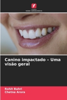 Canino impactado - Uma visão geral (Portuguese Edition) 6630213688 Book Cover