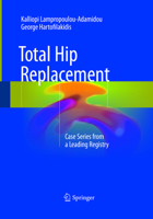 Total Hip Replacement: Case Series from a Leading Registry 3319851330 Book Cover