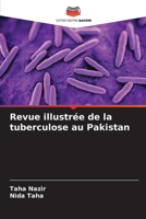 Revue illustrée de la tuberculose au Pakistan (French Edition) 6208599687 Book Cover