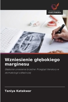 Wzniesienie glebokiego marginesu (Polish Edition) 6209820336 Book Cover