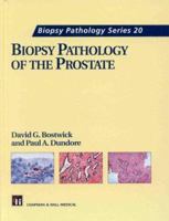 Biopsy Pathology of the Prostate (Biopsy Pathology Series) 0412755106 Book Cover
