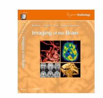 Imaging of the Brain: Expert Radiology Series 1416050094 Book Cover