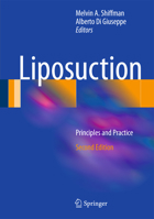 Liposuction: Principles and Practice 3662489015 Book Cover