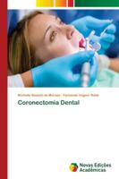 Coronectomia Dental 6139659337 Book Cover
