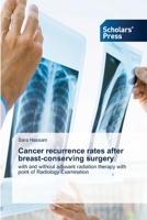 Cancer recurrence rates after breast-conserving surgery 620903134X Book Cover