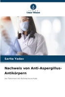 Nachweis von Anti-Aspergillus-Antikörpern (German Edition) 6203555339 Book Cover