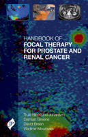 Handbook of Focal Therapy for Prostate and Renal Cancer 1909836117 Book Cover